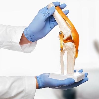 Knee implants Ceiling Prices