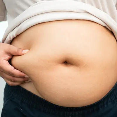 Bariatric Surgery