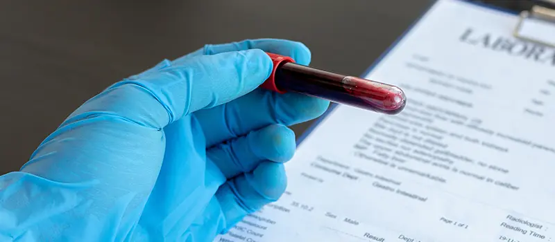 Hematology