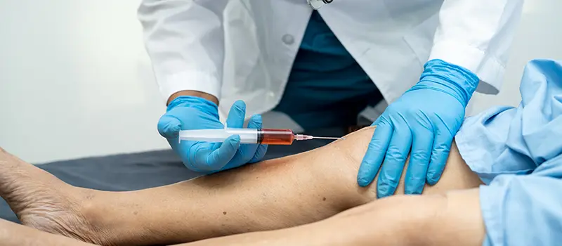 Vascular Surgery